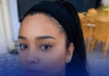 FLAVIA FERNANDES MORRE APOS TER SIDO SUBMETIDA A PROCEDIMENTO DE ESTETICA